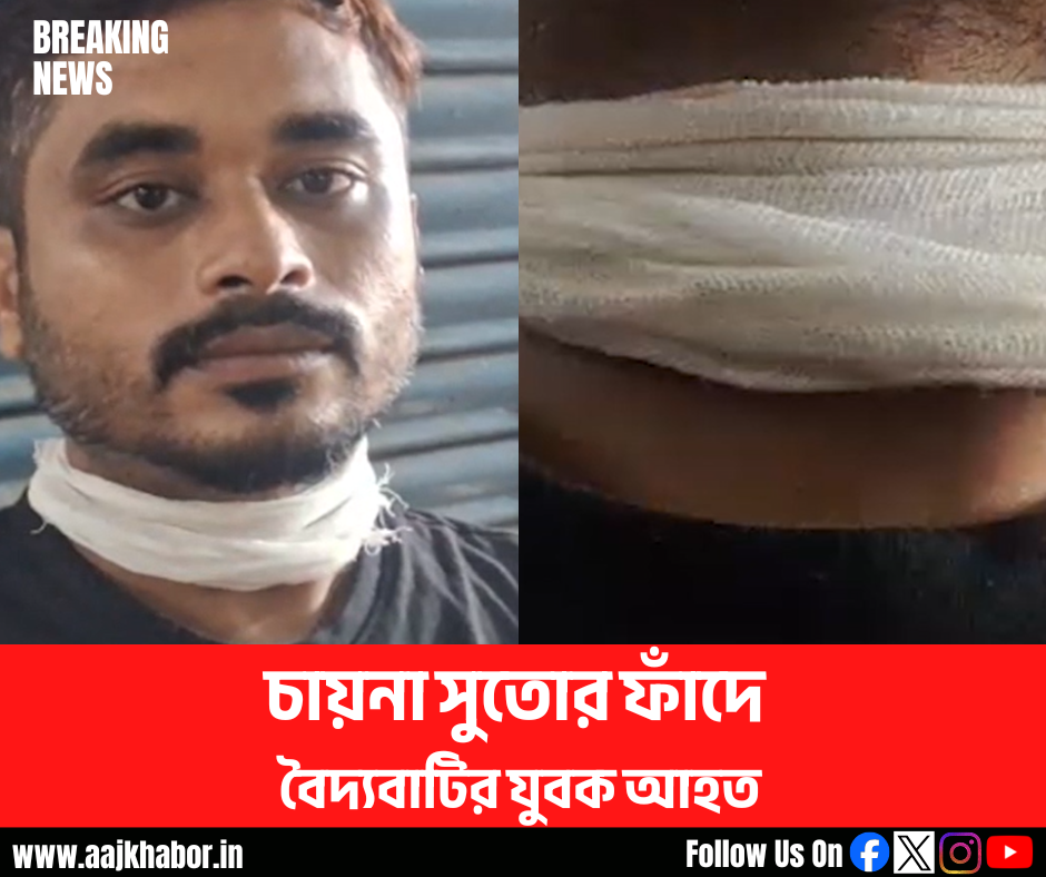 চায়না সুতোর ফাঁদে বৈদ্যবাটির যুবক আহত